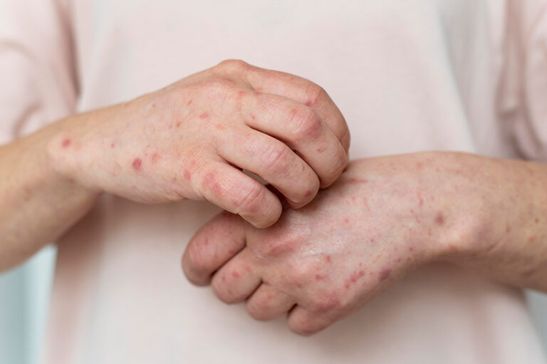 Choroby skóry: Czym zajmuje się dermatolog?