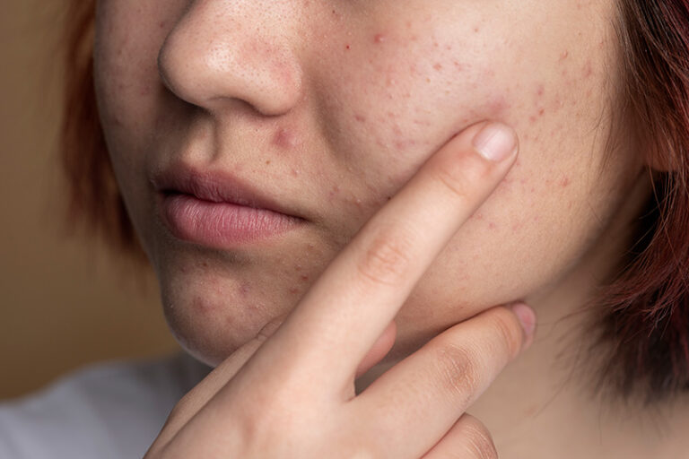 10 najczęstszych problemów skórnych, z którymi pacjenci zgłaszają się do dermatologa